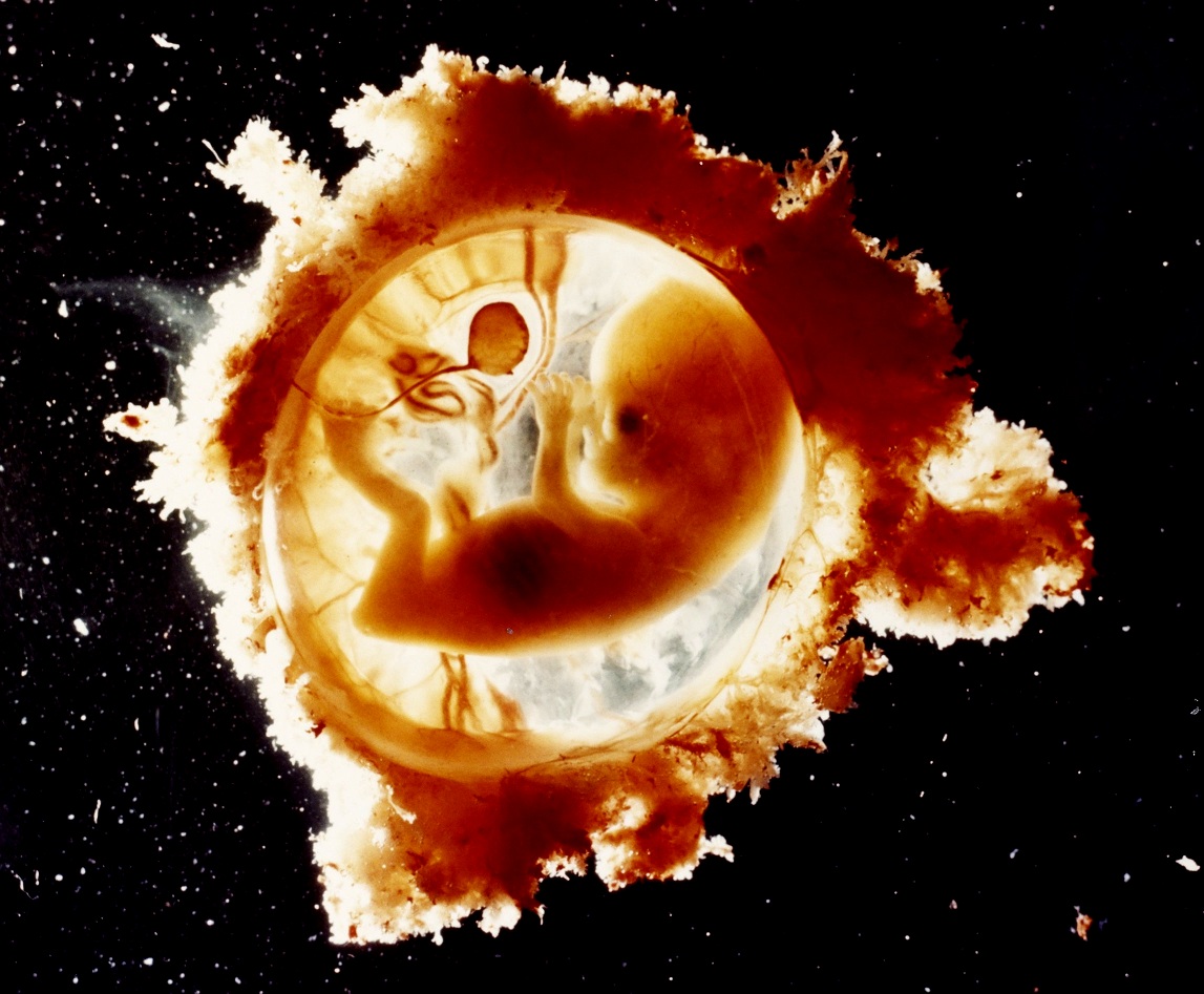 photo of 5 week old fetus
